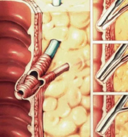 Postcholecystectomical szindróma besorolás, gyógyszeres kezelés és diéta