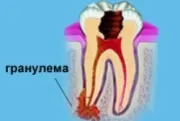 Premedication în indicații dentare, formulări comentarii