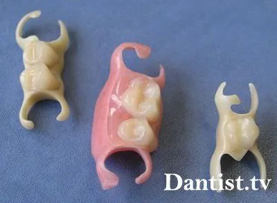 Протезиране първични зъби при децата на цените, видове и снимки