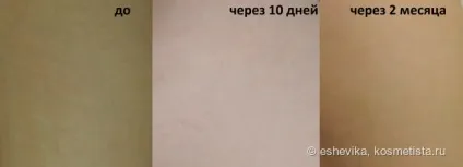 Lierac phytostil в боротьбі з розтяжками відгуки (lierac) Lierac phytostil в боротьбі з розтяжками відгуки