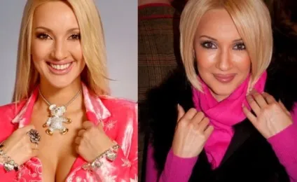 Лера кудрявцева фото до і після пластики - 300 (пластики) Лера кудрявцева фото до і після пластики - 300