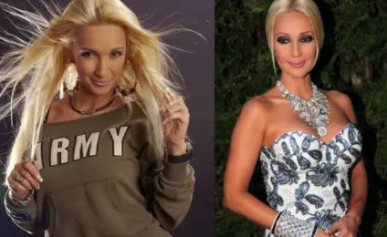 Лера кудрявцева фото до і після пластики - 300 (пластики) Лера кудрявцева фото до і після пластики - 300