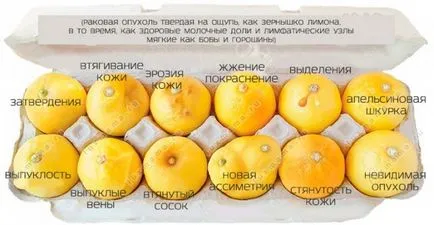 Самостійне обстеження грудей