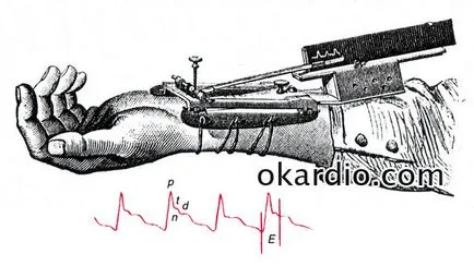 Sphygmography описание на процедурата е, че тя дава плюсовете и минусите