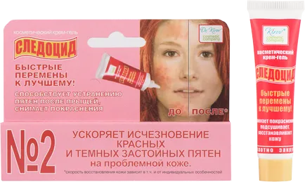 Sos! Як замаскувати прищі і постакне
