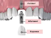 Stomatologie Dental Diamond