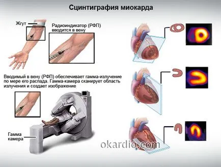 Studiile scintigrafie miocardică sunt pe măsură ce trece, dovezi