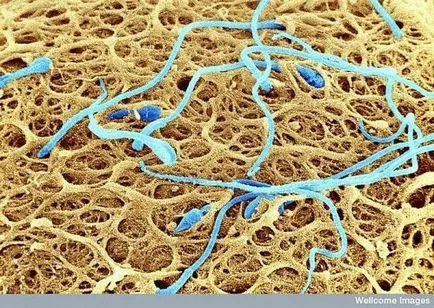 țesuturi umane și organe sub microscop (15 fotografii)