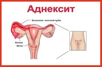 Дърпа кръста след месеци на това, което той говори за симптом