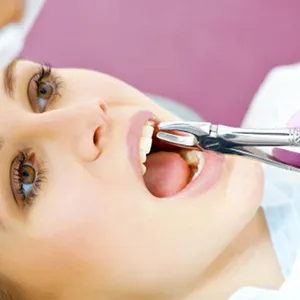 Extracții fără durere, extracția dentară sub anestezie generală, costul îndepărtării dentare clinicii CELT