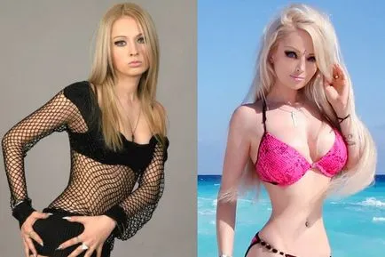 Валерия Лукянова - снимки преди и след пластична хирургия