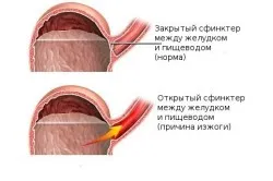 Заболявания на симптомите на стомаха и лечение, диета (снимка)