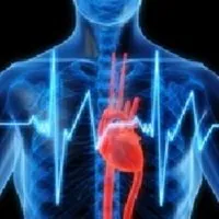 5 szabályok után a betegek szívinfarktus - szike - Orvosi