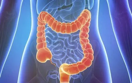 Adenocarcinoma a tünetek, diagnózis, kezelés, típusai