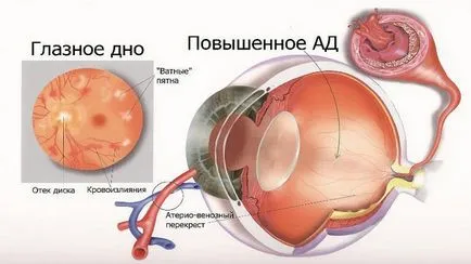 ретината вазоконстрикция очи