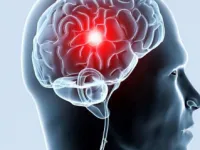 Ateroskleroz golovnogo mozga sosudov medikamentoznoe tratamente