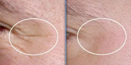 Масажер для обличчя омолодження шкіри 3-в-1 beauty iris m709, gezatone, ціна - 6599 руб, купити с (масажер) Масажер для обличчя омолодження шкіри 3-в-1 beauty iris m709, gezatone, ціна - 6599 руб, купити з