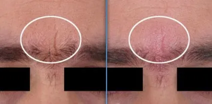 Масажер для обличчя омолодження шкіри 3-в-1 beauty iris m709, gezatone, ціна - 6599 руб, купити с (особи) Масажер для обличчя омолодження шкіри 3-в-1 beauty iris m709, gezatone, ціна - 6599 руб, купити з