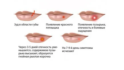 Какво ще се случи, ако сълзотворен херпес