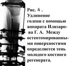 Методи лікування в травматології і ортопедії (методи лікування в травматології і ортопедії) Методи лікування в травматології і ортопедії