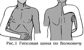 Методи лікування в травматології і ортопедії (методи лікування в травматології і ортопедії) Методи лікування в травматології і ортопедії