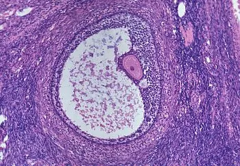 Forma ovulului, ovulul ovulului deformate neregulat