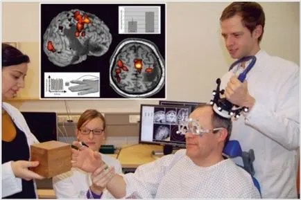 creier stimulare magnetica transcraniana profunda