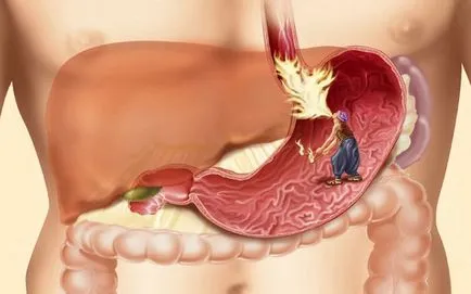 Ce medicamente sunt utilizate pentru a trata intestinului