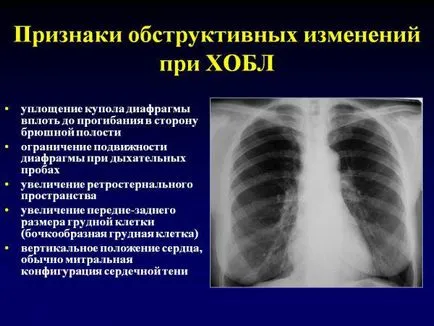 Hogyan kezeljük COPD kezelés gyógyszerek, népi sredtsvami krónikus obstruktív tüdőbetegség