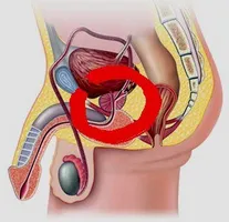 Как може бързо да се лекува простатит при мъжете