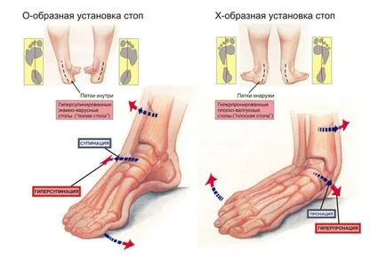 Cum de a preveni dezvoltarea de platfus