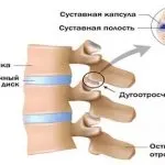 Как да кандидатствате пластир за лечение на китайски стави