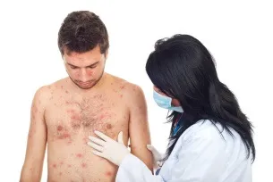 Як лікувати глаукому