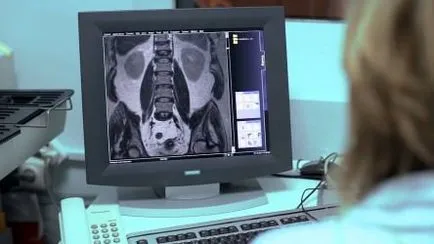 Компресійний перелом хребта лікування і реабілітація (компресійний перелом хребта) Компресійний перелом хребта лікування і реабілітація