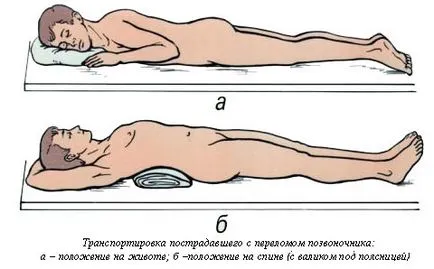 Компресійний перелом хребта лікування і реабілітація (лікування) Компресійний перелом хребта лікування і реабілітація