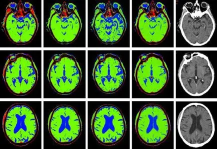 CT на мозъка показания и противопоказания