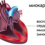 Чи можна померти від пневмонії смертельно чи запалення легенів