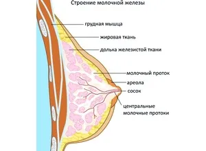 Набухання молочних залоз