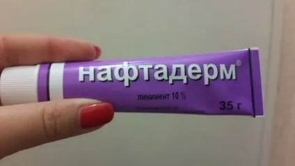 Нафталановиє ванни показання, протипоказання і відгуки (нафталановиє) Нафталановиє ванни показання, протипоказання та відгуки
