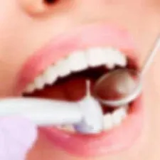 Лечение на зъбите кисти в Челябинск