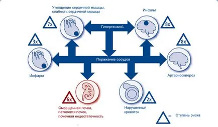 Лечение на хипертония при бъбречна недостатъчност чесън лечение на високо кръвно налягане