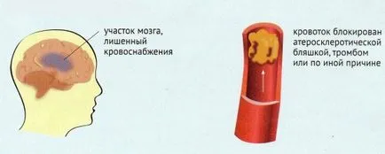 Мрт судин головного мозку що показує (судин головного мозку) Мрт судин головного мозку що показує