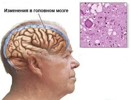 Мрт судин головного мозку що показує (показує) Мрт судин головного мозку що показує