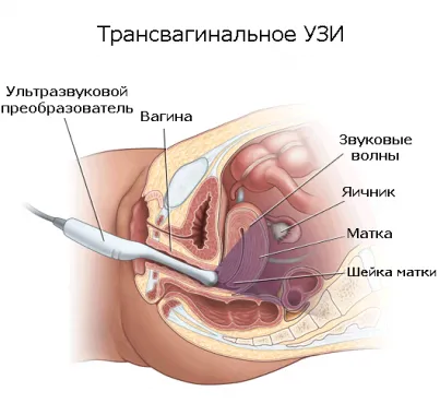 На кой ден от цикъла се направи ултразвуково изследване на матката и придатъците