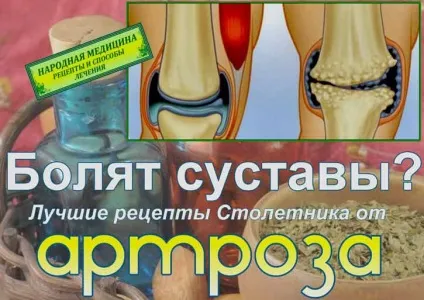 Народні засоби при артрозі, столітник (народні) Народні засоби при артрозі, столітник