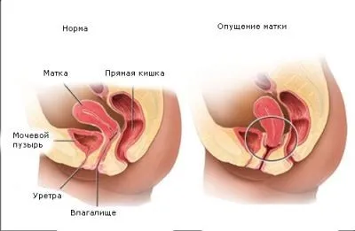 Пропускането на матката, да се грижи за невидимото