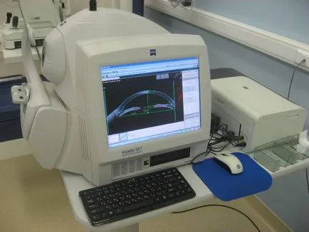 tomografia optica coerenta a retinei si a nervului optic