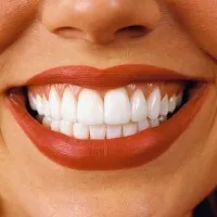 Fehérítőszerek a fogak készítmények, fogászati ​​kezelés