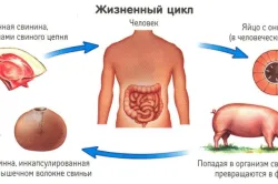 Подкожните червеи и паразити симптоми, лечение