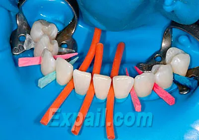 Mobilitatea Tooth cauze, sau tratamentului